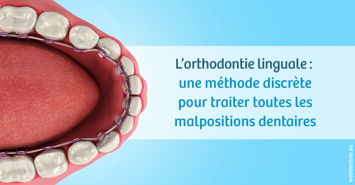 https://dr-durant-valery.chirurgiens-dentistes.fr/L'orthodontie linguale 1