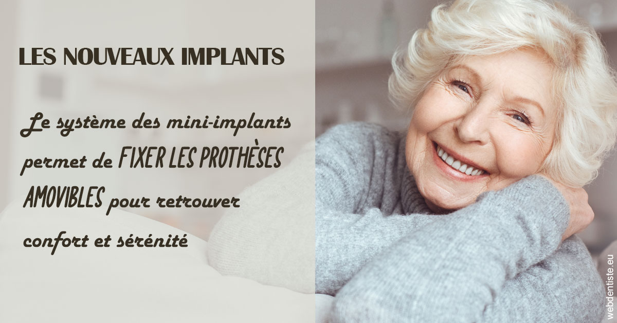https://dr-durant-valery.chirurgiens-dentistes.fr/Les nouveaux implants 1