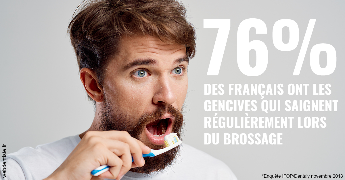 https://dr-durant-valery.chirurgiens-dentistes.fr/76% des Français 2