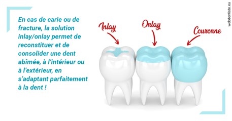 https://dr-durant-valery.chirurgiens-dentistes.fr/L'INLAY ou l'ONLAY