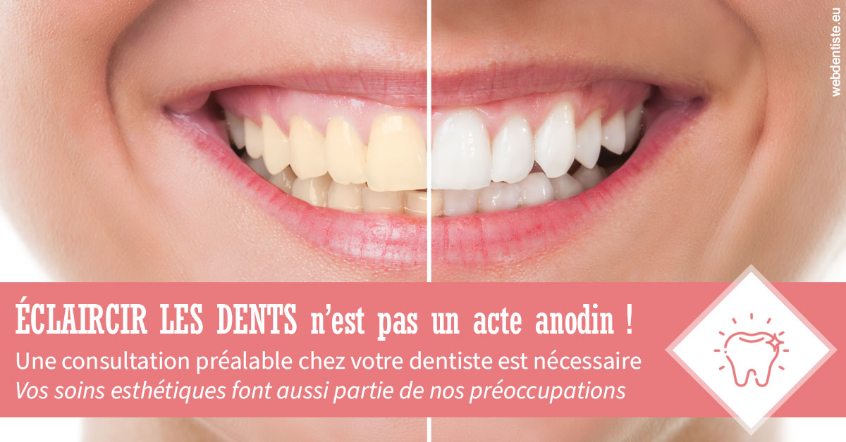 https://dr-durant-valery.chirurgiens-dentistes.fr/Eclaircir les dents 1