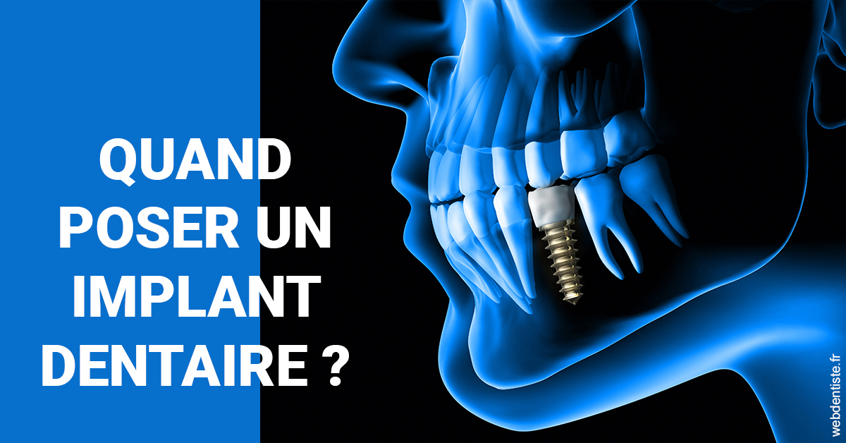 https://dr-durant-valery.chirurgiens-dentistes.fr/Les implants 1