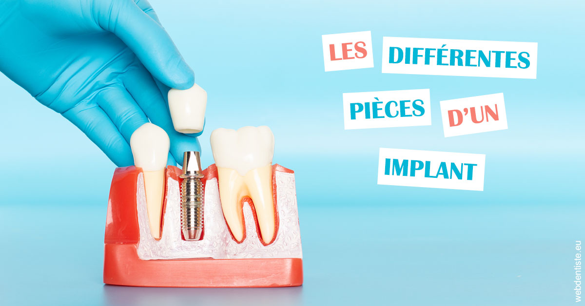 https://dr-durant-valery.chirurgiens-dentistes.fr/Les différentes pièces d’un implant 2