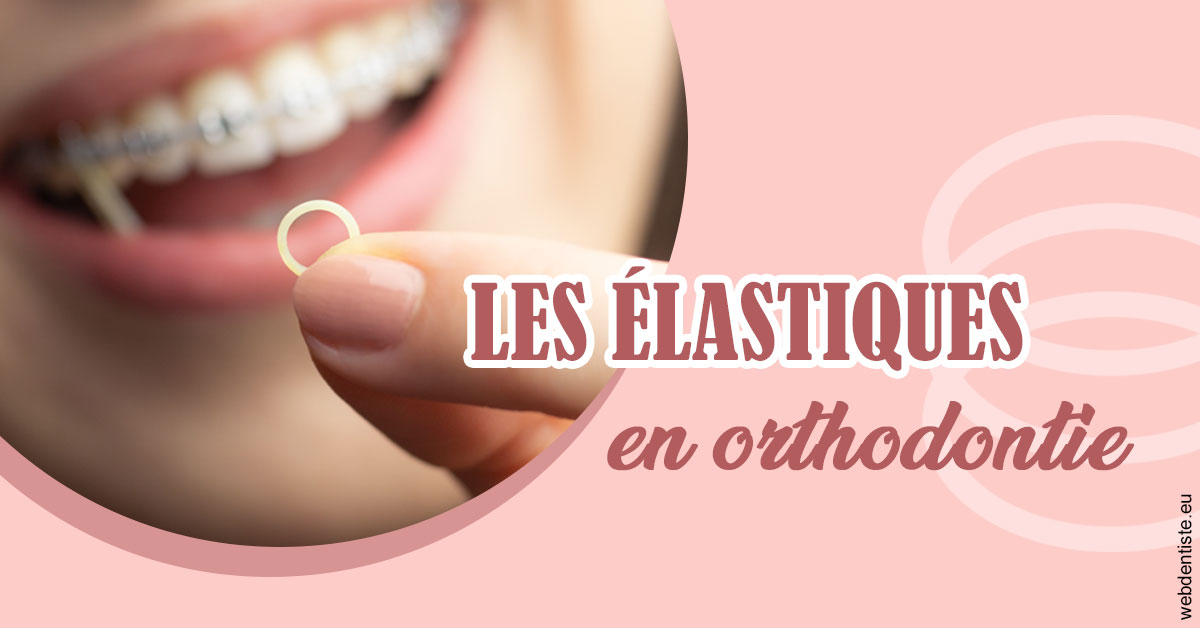 https://dr-durant-valery.chirurgiens-dentistes.fr/Elastiques orthodontie 1