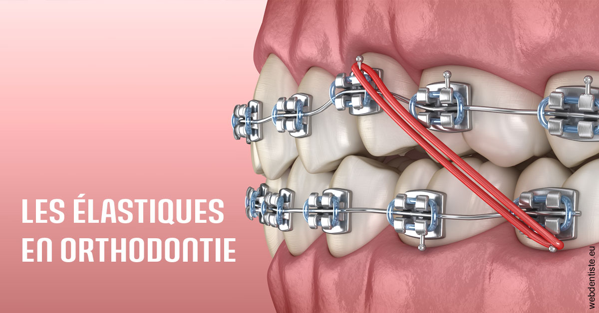 https://dr-durant-valery.chirurgiens-dentistes.fr/Elastiques orthodontie 2